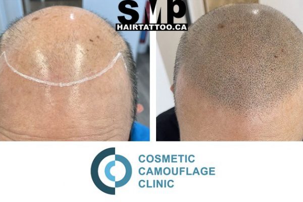 Beforeandafter-SMP9 Beforeandafter-SMP9
